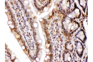 LDHA was detected in paraffin-embedded sections of rat intestine tissues using rabbit anti- LDHA Antigen Affinity purified polyclonal antibody (Catalog # ) at 1 ? (Lactate Dehydrogenase A antibody  (AA 2-106))