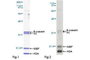 IRAK4 Protein (AA 1-460) (GST tag)