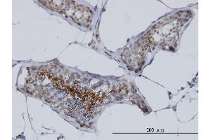 Immunoperoxidase of monoclonal antibody to AKAP4 on formalin-fixed paraffin-embedded human testis. (AKAP4 antibody  (AA 1-100))