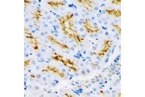 Immunohistochemistry (IHC) image for anti-UDP-Glucose 6-Dehydrogenase (UGDH) antibody (ABIN7308478) (UGDH antibody)