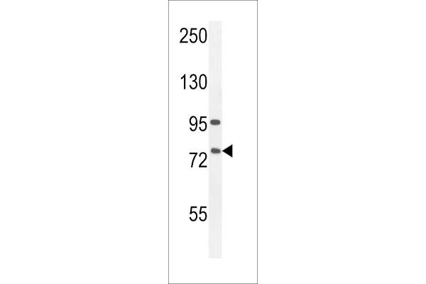 ALOX12B antibody  (C-Term)