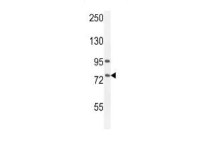 ALOX12B anticorps  (C-Term)
