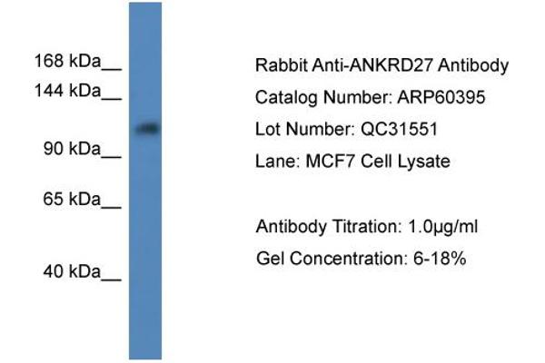 ANKRD27 Antikörper  (C-Term)