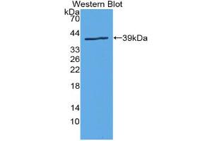 Western blot analysis of the recombinant protein. (SLC6A3 antibody  (AA 562-620))