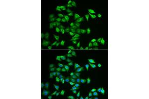 Immunofluorescence analysis of A549 cells using POMGNT2 antibody (ABIN5973878).