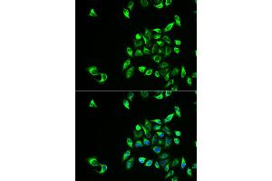 Immunofluorescence analysis of HeLa cell using CSNK1A1L antibody. (CSNK1A1L antibody)