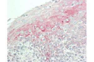 Human Tonsil: Formalin-Fixed, Paraffin-Embedded (FFPE) (CLUH antibody  (AA 1259-1309))