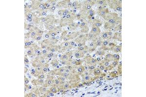 Immunohistochemistry of paraffin-embedded human liver injury using OSGEPL1 antibody at dilution of 1:100 (x40 lens). (OSGEPL1 antibody)