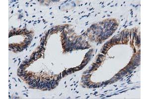 Immunohistochemical staining of paraffin-embedded Human Kidney tissue using anti-GAS7 mouse monoclonal antibody. (GAS7 antibody)