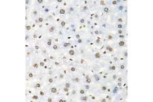 Immunohistochemistry of paraffin-embedded mouse liver using IGF2BP2 antibody (ABIN5971464) at dilution of 1/100 (40x lens). (IGF2BP2 antibody)
