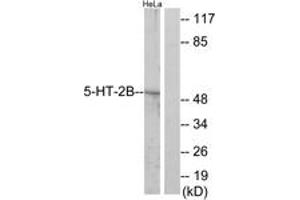Western blot analysis of extracts from HeLa cells, using 5-HT-2B Antibody. (Serotonin Receptor 2B antibody  (AA 261-310))
