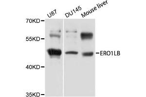 Western blot analysis of extracts of various cell lines, using ERO1LB antibody (ABIN5971901) at 1/1000 dilution. (ERO1LB antibody)