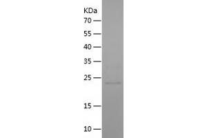 Western Blotting (WB) image for UL16 Binding Protein 2 (ULBP2) (AA 25-224) protein (His tag) (ABIN7125652)