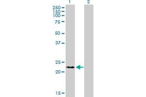 Western Blot analysis of RNF166 expression in transfected 293T cell line by RNF166 MaxPab polyclonal antibody. (RNF166 antibody  (AA 1-237))
