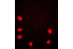 Immunofluorescent analysis of Rpb1 CTD staining in HeLa cells. (Rpb1 CTD antibody  (C-Term))