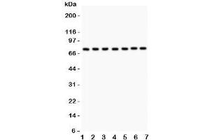 Western blot testing of GCLC antibody and Lane 1:  rat brain;  2: (r) heart;  3: human HeLa;  4: (r) PC12;  5: (r) NRK;  6: mouse HEPA;  7: (h) A549.
