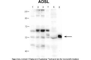 Sample Type: 1. (Adenylosuccinate Lyase antibody  (Middle Region))