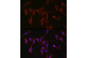Immunofluorescence analysis of NIH/3T3 cells using PKC zeta Rabbit pAb (ABIN6128468, ABIN6146211, ABIN6146213 and ABIN6221376) at dilution of 1:100 (40x lens). (PKC zeta antibody  (AA 453-592))