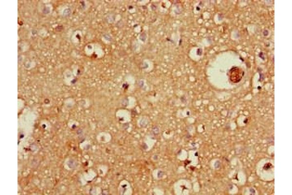 ZFYVE26 antibody  (AA 2306-2473)