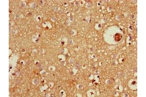 Immunohistochemistry of paraffin-embedded human brain tissue using ABIN7176064 at dilution of 1:100 (ZFYVE26 antibody  (AA 2306-2473))
