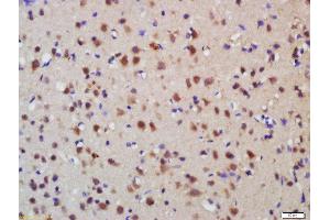 Formalin-fixed and paraffin embedded rat brain labeled with Anti-Melanoregulin Polyclonal Antibody, Unconjugated  at 1:200 followed by conjugation to the secondary antibody and DAB staining