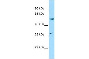 WB Suggested Anti-Ccnl1 Antibody Titration: 1. (Cyclin L1 antibody  (N-Term))