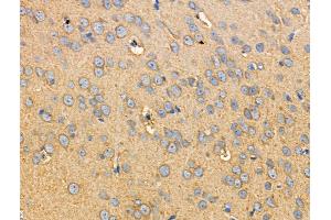 ABIN6255025 and ABIN6266462 at 1/100 staining Rat brain tissue by IHC-P.