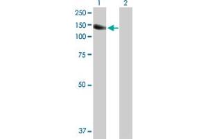 Western Blot analysis of PTK2B expression in transfected 293T cell line by PTK2B MaxPab polyclonal antibody. (PTK2B antibody  (AA 1-1009))