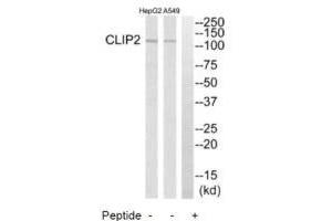 Western blot analysis of extracts from HepG2 cells and A549 cells, using CLIP2 antibody.