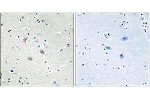 Immunohistochemistry analysis of paraffin-embedded human brain tissue, using Akt2 (Ab-474) Antibody. (AKT2 antibody  (AA 432-481))