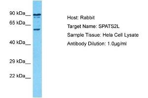 Host: Rabbit Target Name: SPATS2L Sample Type: Hela Whole Cell lysates Antibody Dilution: 1. (SPATS2L antibody  (C-Term))