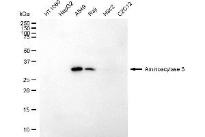 anti-Aminoacylase 3 (ACY3) antibody