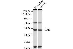 Western blot analysis of extracts of various cell lines, using CLN3 antibody (ABIN3015724, ABIN3015725, ABIN1679284 and ABIN6219075) at 1:1000 dilution. (CLN3 antibody  (AA 1-280))
