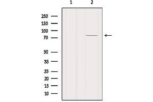 Western blot analysis of extracts from Mouse lung, using MAGC3 Antibody. (MAGEC3 antibody)