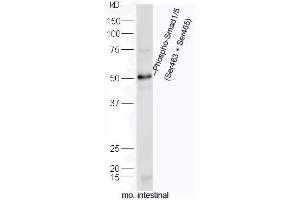 Mouse intestine lysates probed with Rabbit Anti-Smad1/5 (Ser463+Ser465) Polyclonal Antibody, Unconjugated (ABIN746033) at 1:300 overnight at 4˚C. (Smad1/5 antibody  (pSer463, pSer465))
