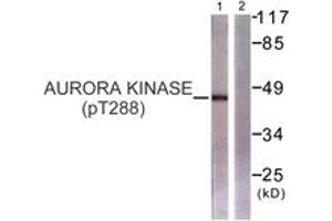 Western blot analysis of extracts from 293 cells treated with serum 20% 15', using Aurora Kinase (Phospho-Thr288) Antibody. (Aurora Kinase (AA 256-305), (pThr288) antibody)