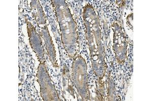 IHC analysis of Integrin beta 4/ITGB4 using anti-Integrin beta 4/ITGB4 antibody (ABIN7601135).