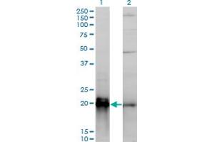 Western Blot analysis of KRAS expression in transfected 293T cell line by KRAS monoclonal antibody (M01), clone 3B10-2F2. (K-RAS antibody  (AA 1-188))