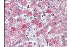 Human Liver (formalin-fixed, paraffin-embedded) stained with SIL1at 5 µg/ml followed by biotinylated anti-goat IgG secondary antibody, alkaline phosphatase-streptavidin and chromogen. (SIL1 antibody  (C-Term))
