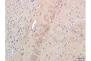 Formalin-fixed and paraffin embedded rat hippocampus labeled with Anti-Nestin Polyclonal Antibody (ABIN723530), Unconjugated 1:300 followed by conjugation to the secondary antibody and DAB staining