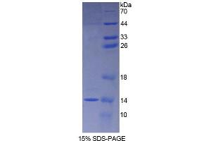 SDS-PAGE (SDS) image for S100 Calcium Binding Protein A8 (S100A8) (AA 1-89) protein (His tag) (ABIN1080749)