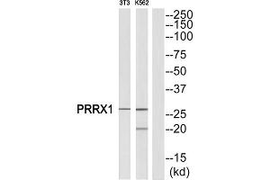 Western Blotting (WB) image for anti-Paired Related Homeobox 1 (PRRX1) (Internal Region) antibody (ABIN1851770)