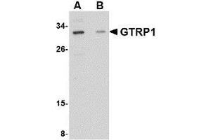 Western blot analysis of GRTP1 in SK-N-SH cell lysate with AP30388PU-N GRTP1 antibody at 1 μg/ml in the (A) absence and (B) presence of blocking peptide. (GRTP1 antibody  (Center))