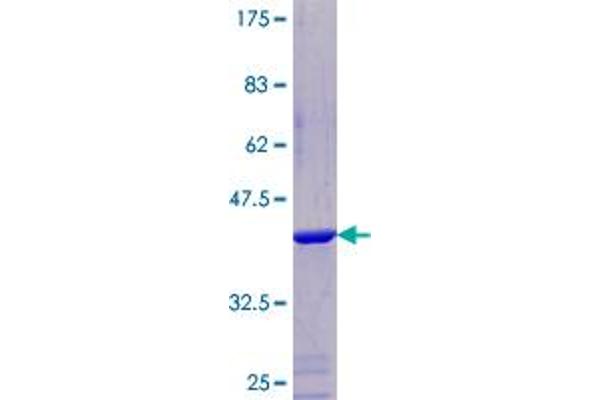 NDUFA5 Protein (AA 1-116) (GST tag)