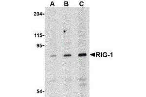 Western Blotting (WB) image for anti-DEAD (Asp-Glu-Ala-Asp) Box Polypeptide 58 (DDX58) antibody (ABIN2476365) (DDX58 antibody)