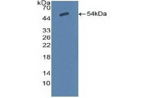 Detection of Recombinant SCNN1a, Human using Polyclonal Antibody to Amiloride Sensitive Sodium Channel Subunit Alpha (SCNN1a) (SCNN1A antibody  (AA 112-543))