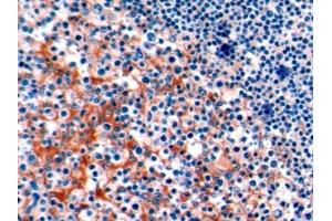Detection of PD1 in Human Tonsil Tissue using Polyclonal Antibody to Programmed Cell Death Protein 1 (PD1) (PD-1 antibody  (AA 41-132))
