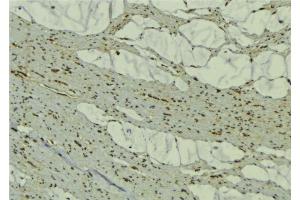 ABIN6277442 at 1/100 staining Mouse muscle tissue by IHC-P. (TRIM63 antibody  (N-Term))
