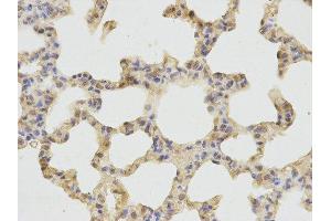 Immunohistochemistry (IHC) image for anti-Cathepsin D (CTSD) antibody (ABIN1872099) (Cathepsin D antibody)