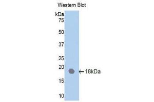 Western Blotting (WB) image for anti-Interleukin 18 Receptor Accessory Protein (IL18RAP) (AA 117-240) antibody (ABIN1859375) (IL18RAP antibody  (AA 117-240))